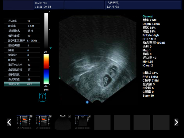 無(wú)痛人流機(jī),無(wú)痛人流做的時(shí)機(jī)